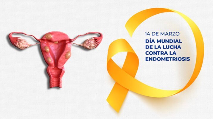 Endometriosis