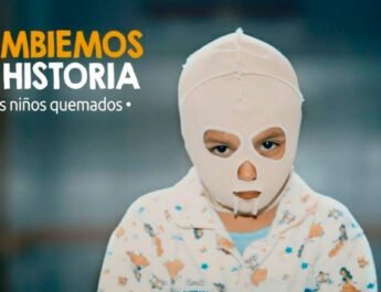 Quemaduras