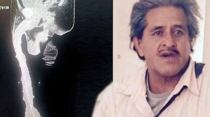 Roberto Esquivel ostenta el récord del pene más largo 1 Roberto Esquivel