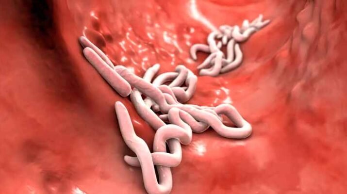 ¿Cómo saber si es colitis o parásitos intestinales? 1 parásitos